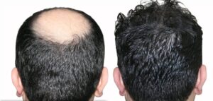 Восстановление волос с безупречным качеством