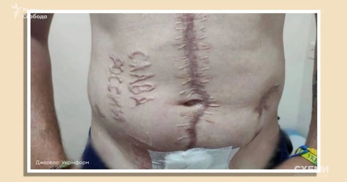 Напис "Слава России" на тілі воїна