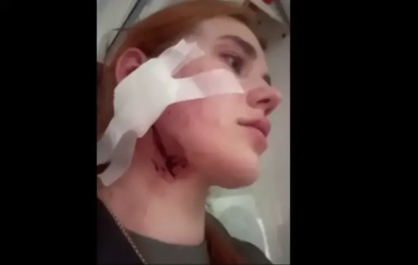 Атака на громадян України в Польщі – українське генконсульство вже відреагувало – відео
