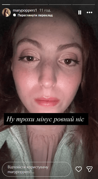 Наслідки ДТП продемонструвала донька Полякової — у дівчини зламаний ніс.